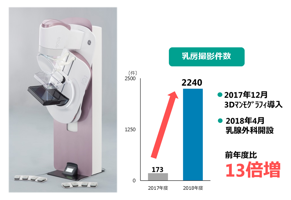 マンモグラフィ マンモグラフィと超音波の併用で 精密に調べる乳がん検診 ...